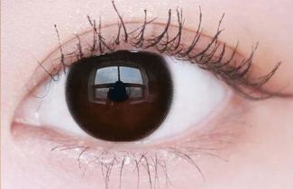 Kính áp tròng thẩm mĩ, lens che khuyết điểm cho mắt sẹo, mắt dị tật, đục thủy tinh thể, Iris contacr